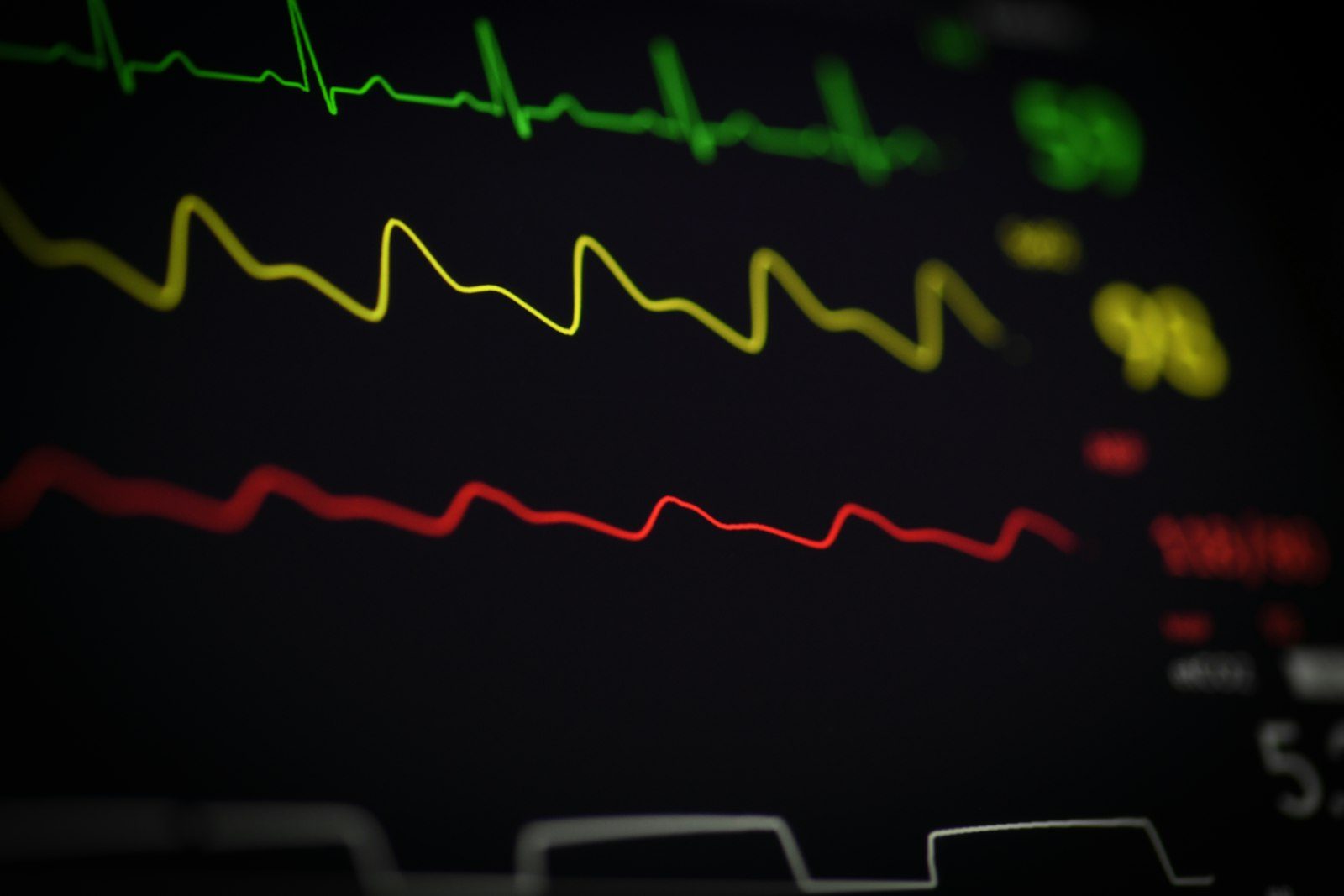 MET Values, RPE, and Heart Rate Zones: How Exercise Scientists Measure Intensity